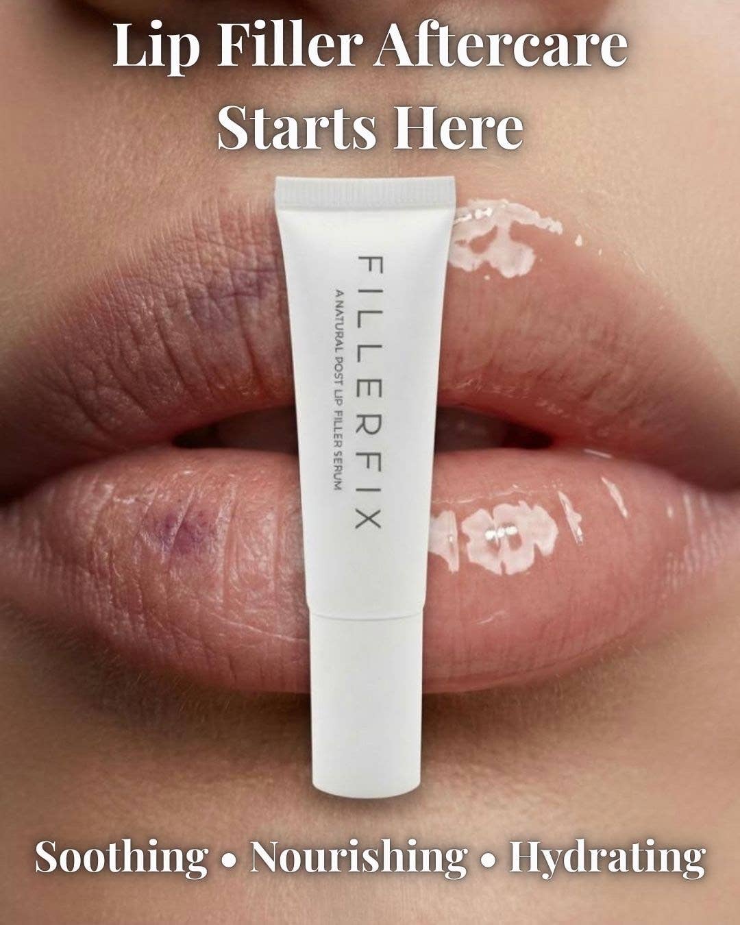FillerFix – Lip Filler Aftercare Serum | Arnica Lip Care
